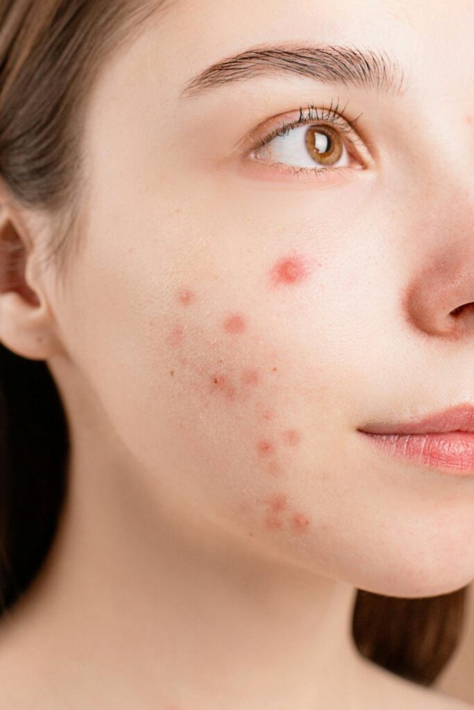 Skincare_for_Sensitive_Skin