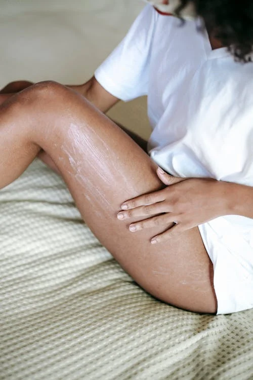 best_stretch_mark_cream